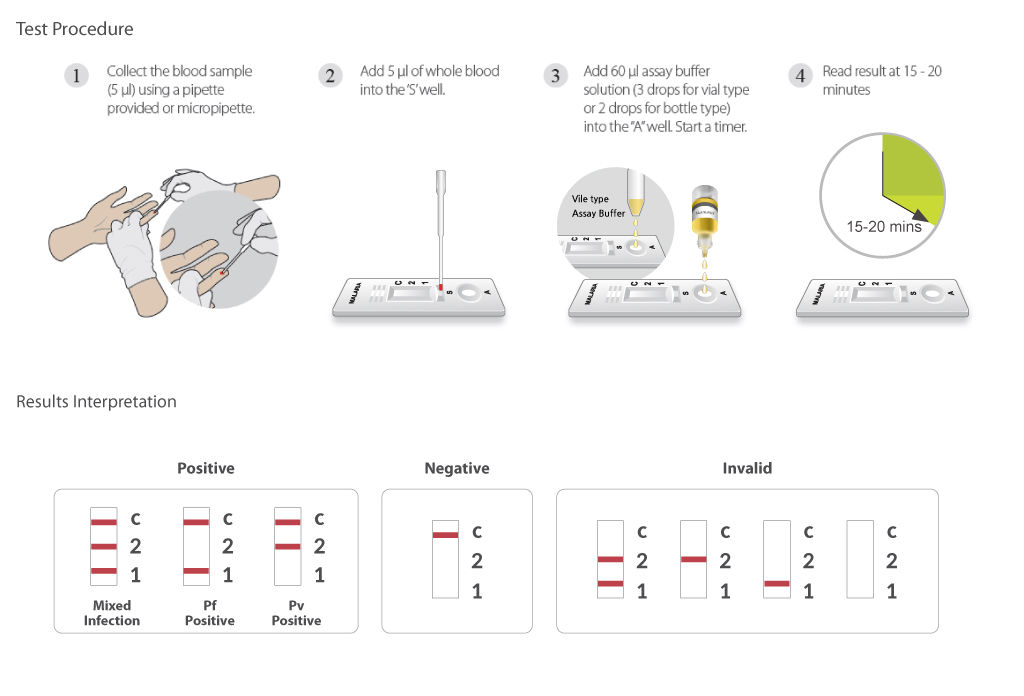 careUS™ Malaria Combo Pf/Pv (HRP2/pLDH) Ag – NEOTEC Medical Services Ltd